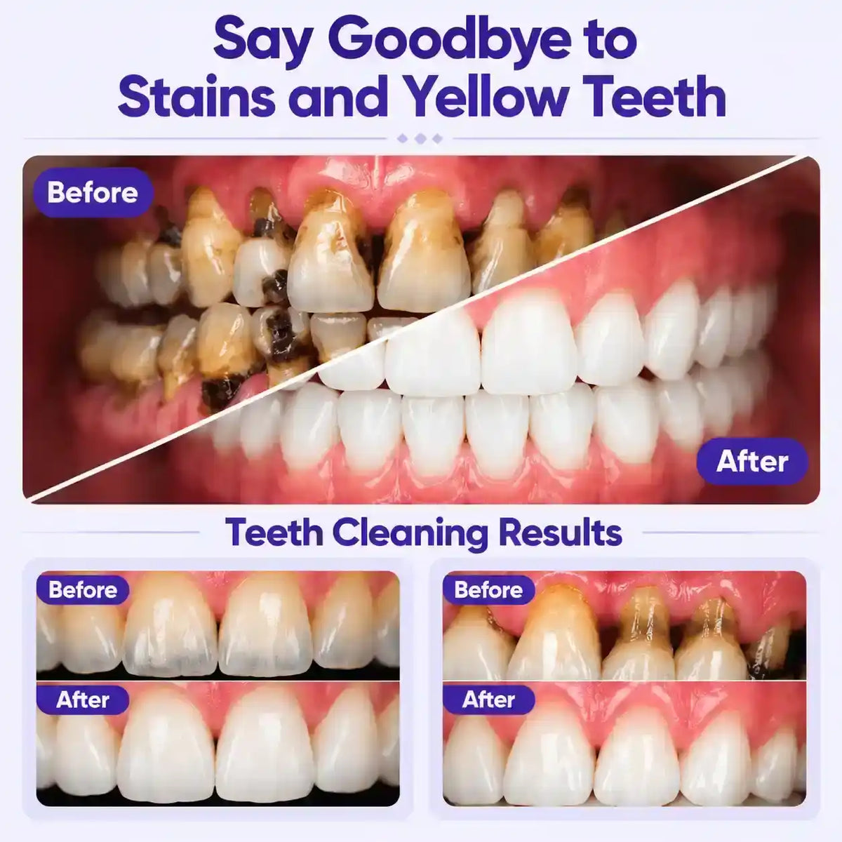 Teeth Whitening Powder