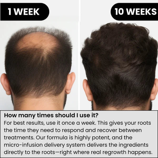 Hair Regrowth System