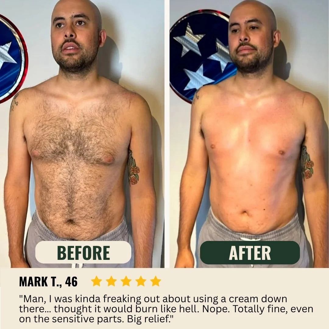 5-Minute Hair Removal Cream