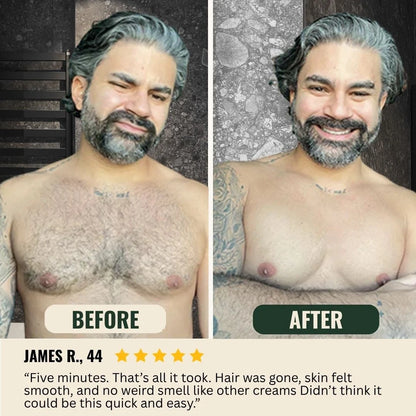 5-Minute Hair Removal Cream